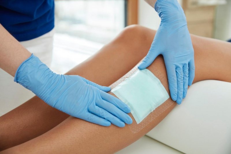 Hydropolymerové krytí Zetuvit Plus Silicone Border—10x10cm, 10ks