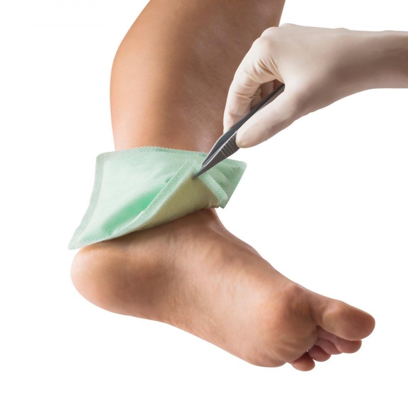 Superabsorpční krytí Zetuvit Plus Silicone—20x20 cm, 10ks