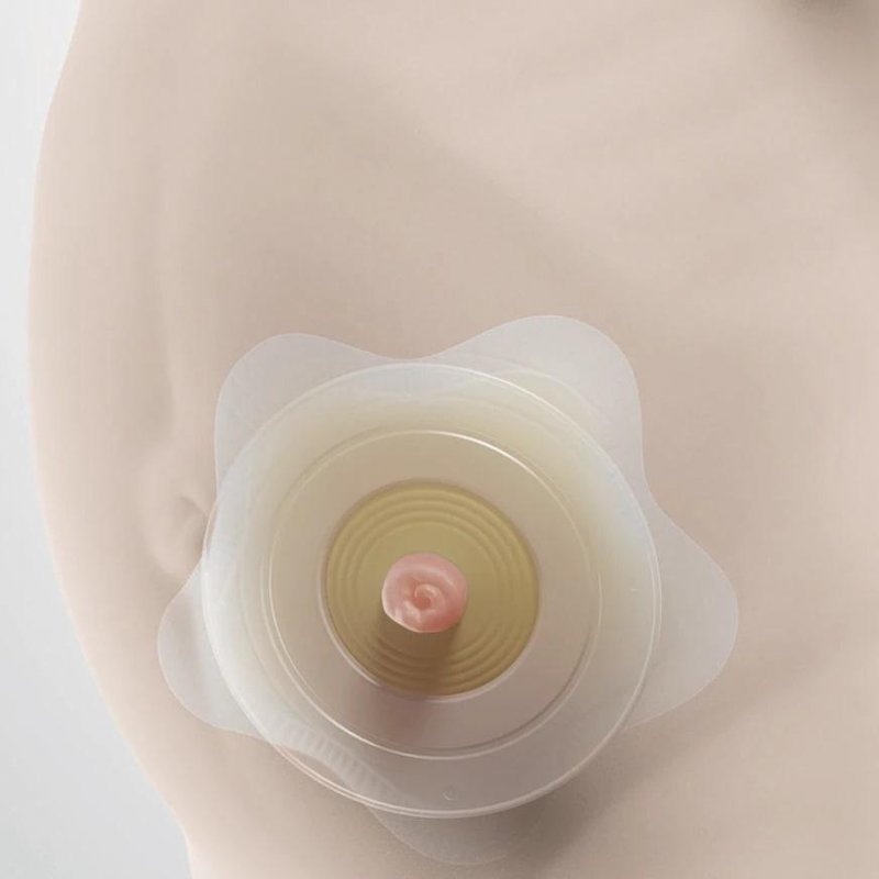 SenSura Mio Kids 2D podložka 5 ks—Pro děti od 6 měsíců do 4 let, otvor 0-27 mm, kroužek 27 mm