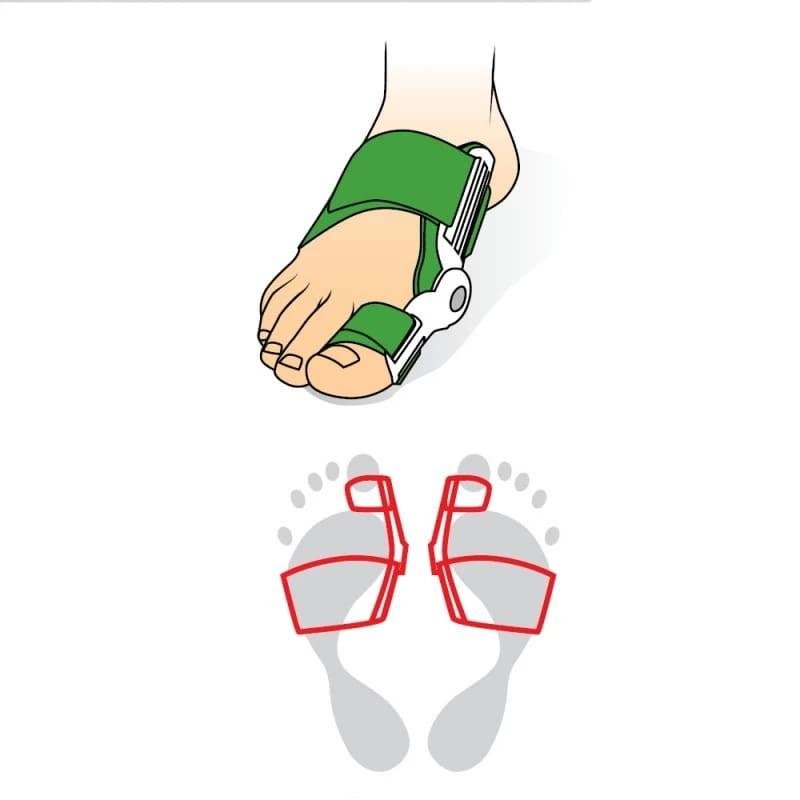 023 Bandáž Hallux Valgus s kloubem 35-42