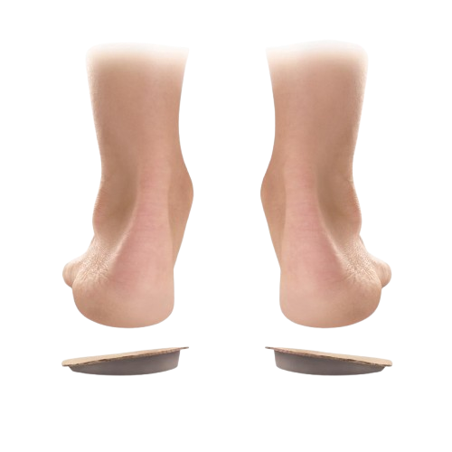 Vybočené postavení chodidel