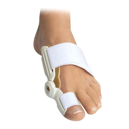 Vbočený palec (hallux valgus)