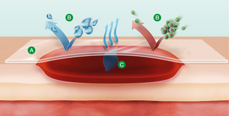 Suprasorb F Protect - 5 cm x 7 cm—Sterilní fóliové krytí transparentní, samolepící, 10 ks