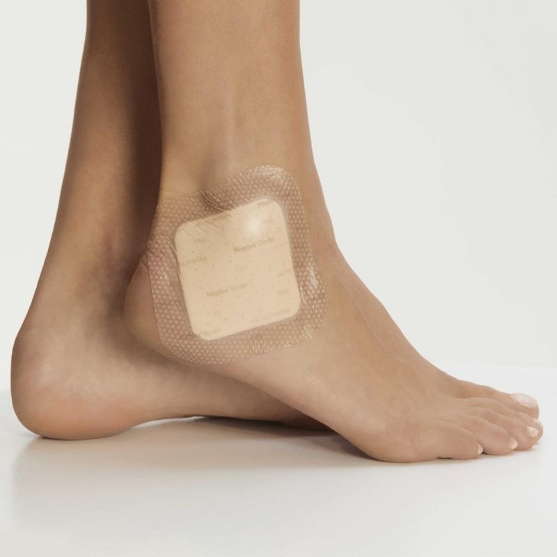 Mepilex Border Flex Lite - 4 x 5 cm—Tenké samolepící pěnové krytí se silikonovou vrstvou, 10 ks