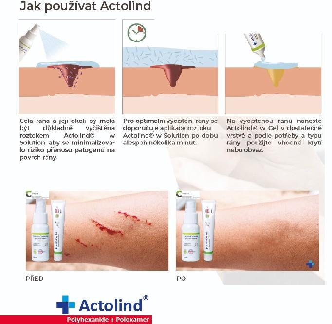 Actolind w Gel—Hydrogel pro urychlení hojení ran a odstranění biofilmu - 10 ml