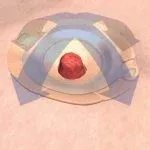 Jednodílný sáček Confidence Natural Soft Convex—Střední, uzavřený, s chlopní, otvor 13-25 mm, 10 ks