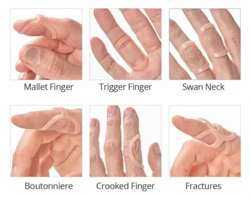 Ortéza prstu P 1008