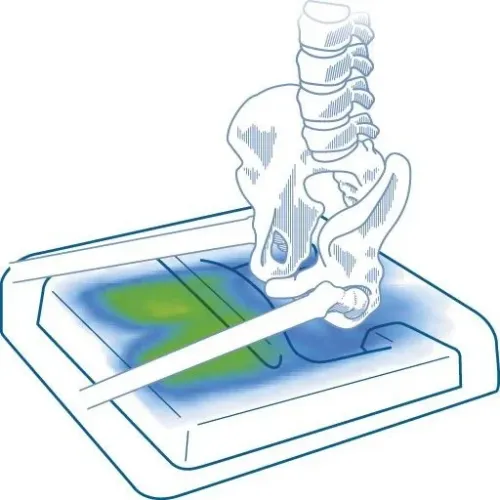 Antidekubitní podložka s pamětí—VISCOFLEX PLUS P361CA, Rozměr 36x36 cm