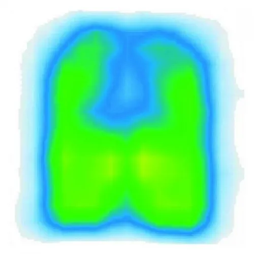 Antidekubitní podložka s pamětí—VISCOFLEX PLUS P361CA, Rozměr 42x50 cm